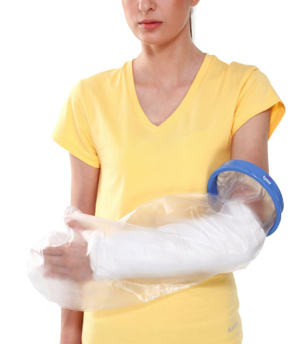 TYNOR Cast Cover Arm (Fs)
