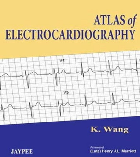 Atlas of Electrocardiography (paperback)