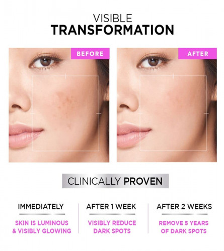 L'Oréal Paris Glycolic Bright Daily Foaming Face Cleanser