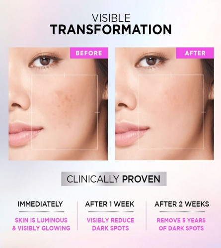 L'Oreal Paris Glycolic Bright Skin Brightening Serum