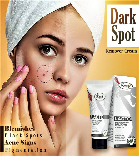 Luster Lacto Dark Spot Remover Cream Brightening & Lightening 60ml (Pack of 4)