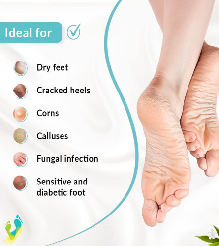 Fixderma Foobetik Cream, Foot cream, Foot care for diabetic, For Dry & Cracked Feet