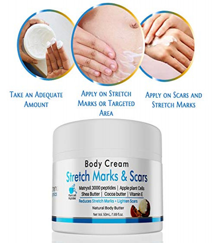 VOLAMENA WITH DEVICE Stretch Marks & Scars Body Cream 50 ml