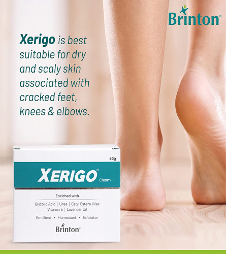 Brinton Xerigo Intense Skin Moisturizing Cream for Cracked Feet, Elbow & Knees 50 gm