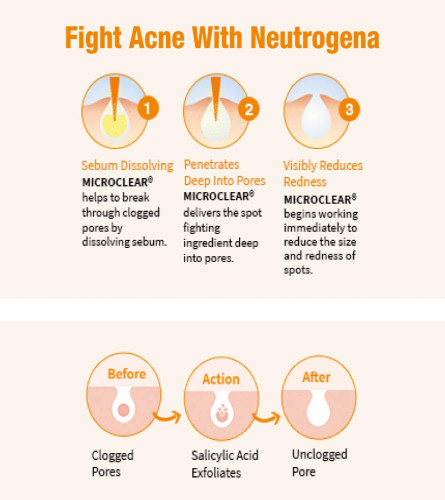 Neutrogena Oil Free Acne Wash