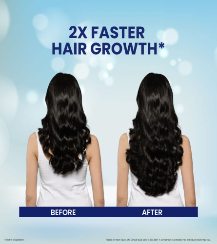 Bajaj Coco Onion Hair Oil