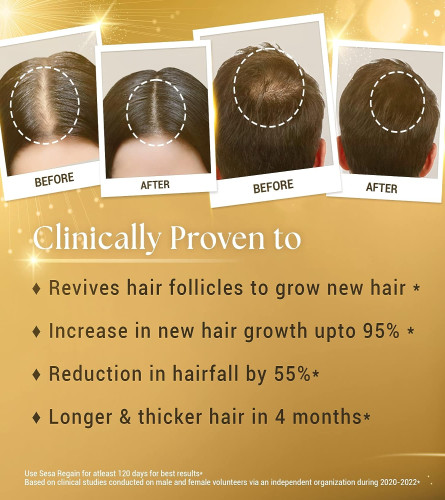 SESA Regain ayurvedic oil