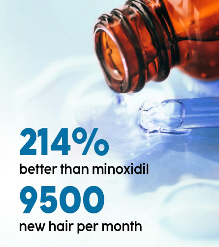 PLIX Hair Growth Serum, Helps reduce Hair Fall & Hair Thinning