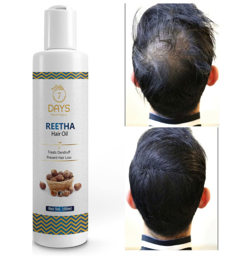 7 Days Reetha Onion Shikakai Bhringraj Amla Hair Oil for Men & Women