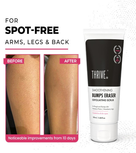 Exfoliante exfoliante ThriveCo Bumps Smoothening Eraser | Para pieles ásperas y con baches