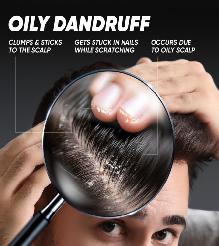 Head & Shoulders Deep Cleanse Anti Dandruff Shampoo 340 ml