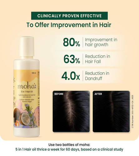 Moha:5 In 1 Hair Oil For Hair Growth & Hair Fall Reduction 100ml (pack of 2) free shipping