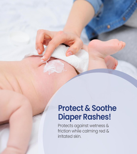 Mother Sparsh Natural Care Baby Diaper Rash Cream 50 g (Pack of 2)