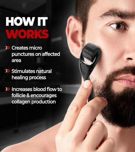 Beardo Beard & Hair Growth Oil 30ml & Derma Roller For Hair Growth 0.5 mm Set of 2 - free shipping