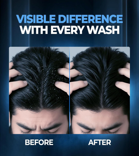 Beardo Dandruff Control Sulphate Free Shampoo for men 200 ml - free shipping
