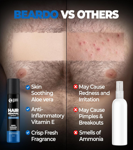 Beardo Hair Removal Spray for Men – Painless 200ml - free shipping