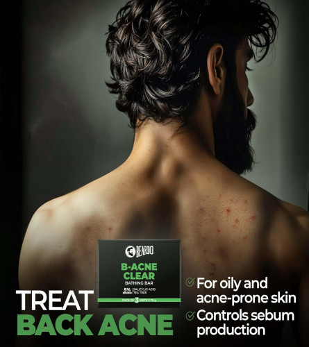 Beardo B- Acne Clear Soap for Men, 75g X 3 Pack (free shipping)