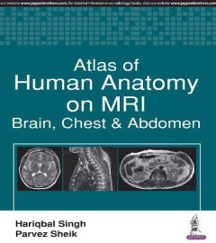 atlas-of-human-anatomy-on-mri-brain-chest-and-abdomen-paperback--isbn-13--978-9386322524